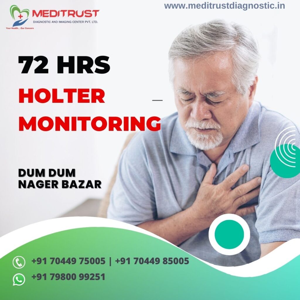 72 Hrs Holter Monitoring in Dum Dum